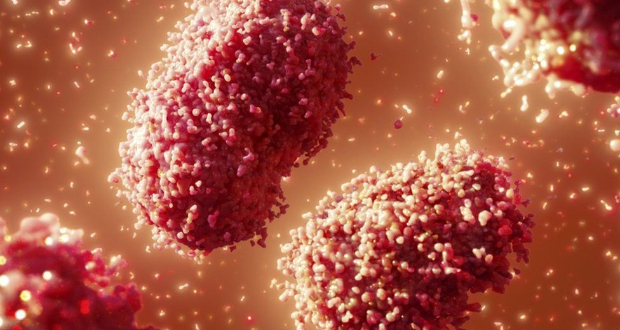 Monkeypox is similar to smallpox but less severe and less infectious too